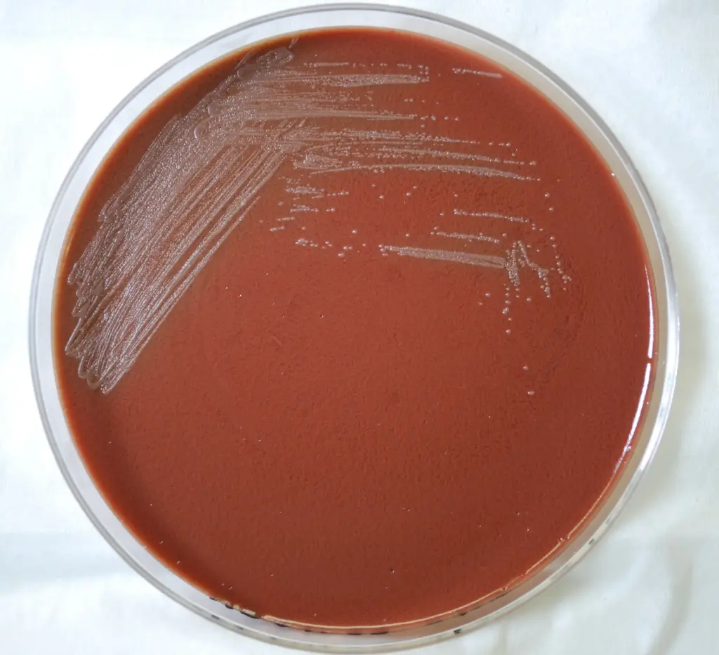 صورة حقيقية لمستعمرات بكتيريا Yersinia pestis المسببة لمرض الطاعون الرئوي